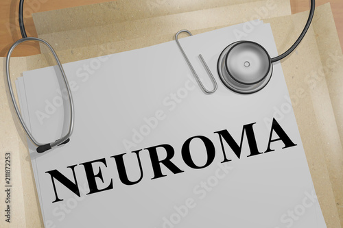 NEUROMA - medical concept photo
