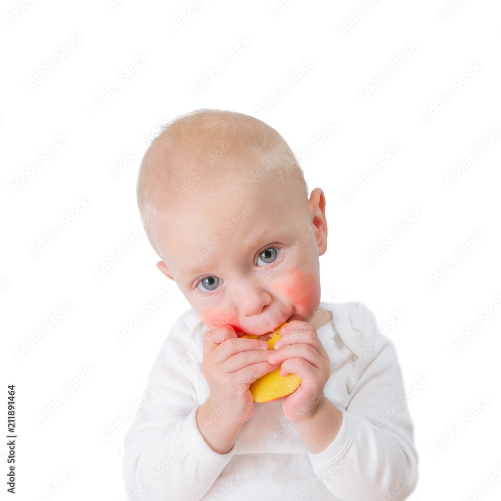 Food allergy concept - baby with dermatitis on cheeks Food allergy concept - baby with dermatitis on cheeks