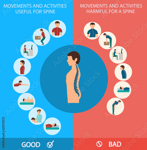 Spine Infographic. Vector Illustration.