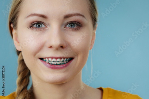 Young woman showing teeth braces