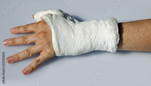 hand with plaster to immobilize the wrist and the thumb photo