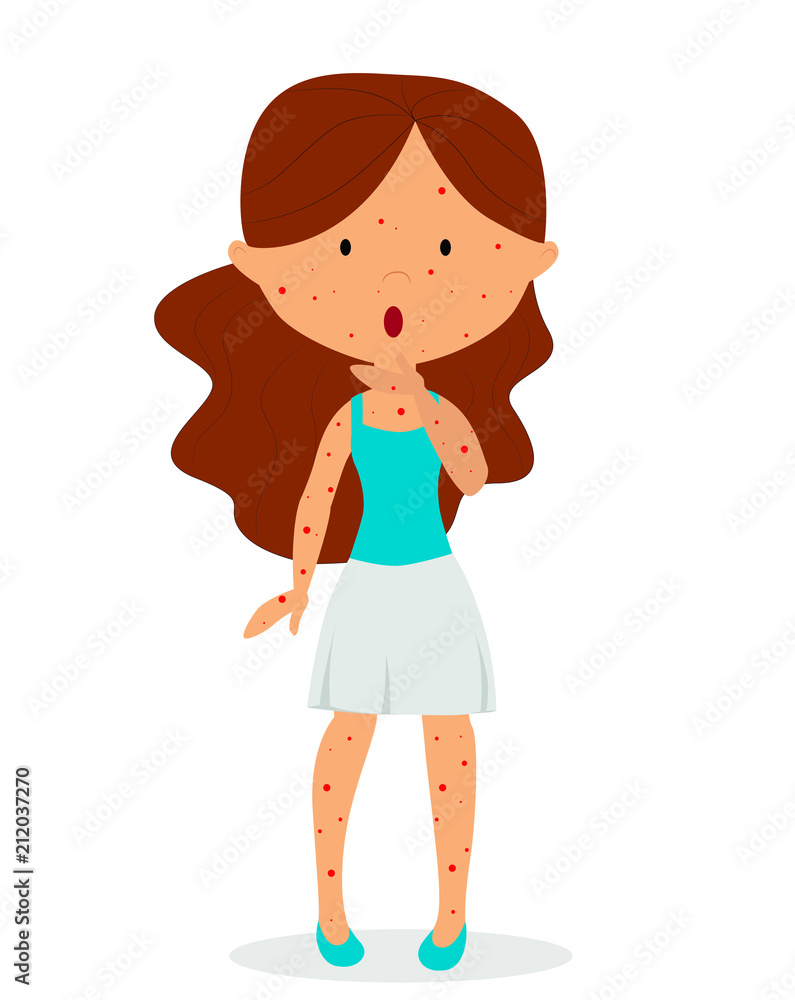vector illustration girl is sick with chickenpox vector illustration girl is sick with chickenpox