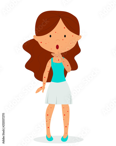  vector illustration girl is sick with chickenpox
