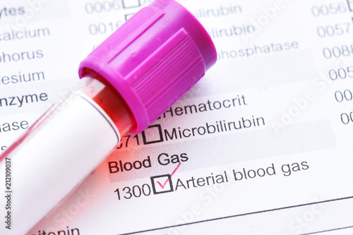 Blood sample tube with laboratory requisition form for arterial blood gas test photo