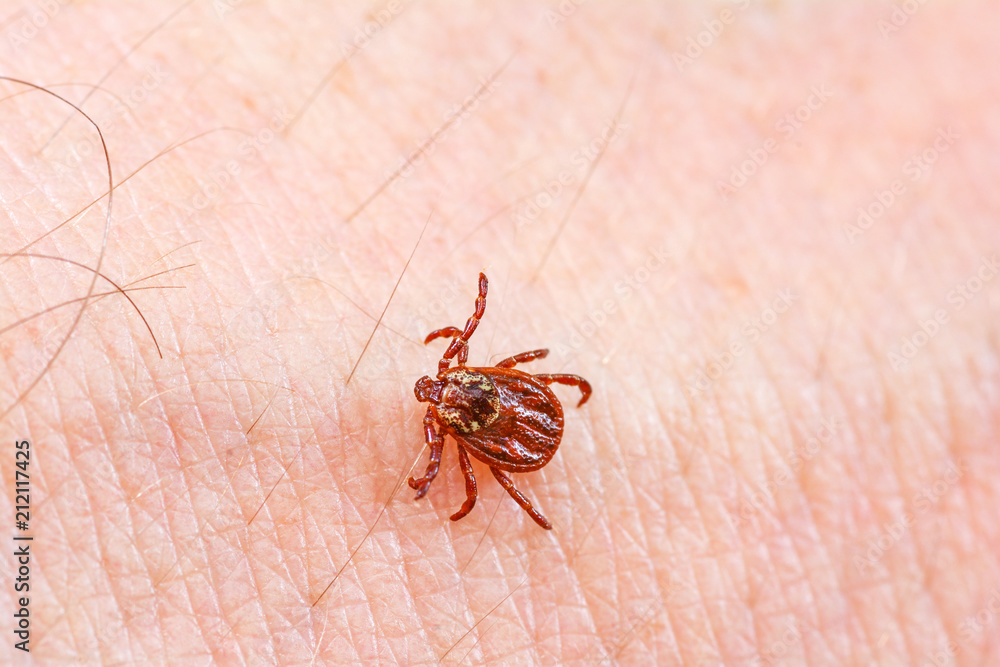 Mite on the skin. Danger of tick bite. Mite on the skin. Danger of tick bite.