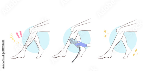 woman leg hair removal concept