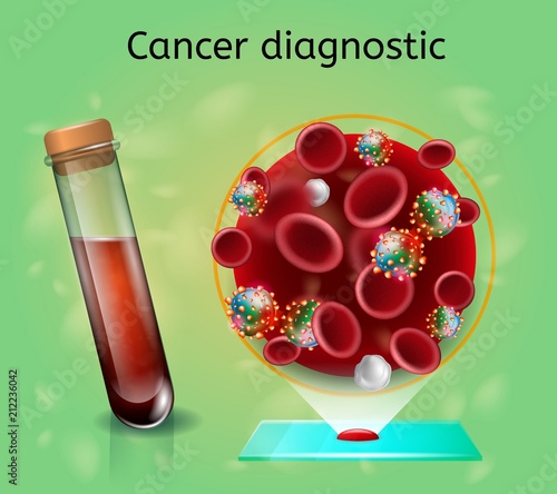 Hematologic Research for Early Cancer Diagnostic