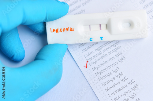 Legionella positive test result by using rapid test cassette photo