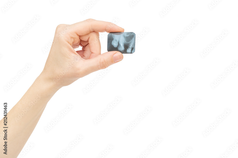 Woman's hand holding dental X-ray. Isolated on white.