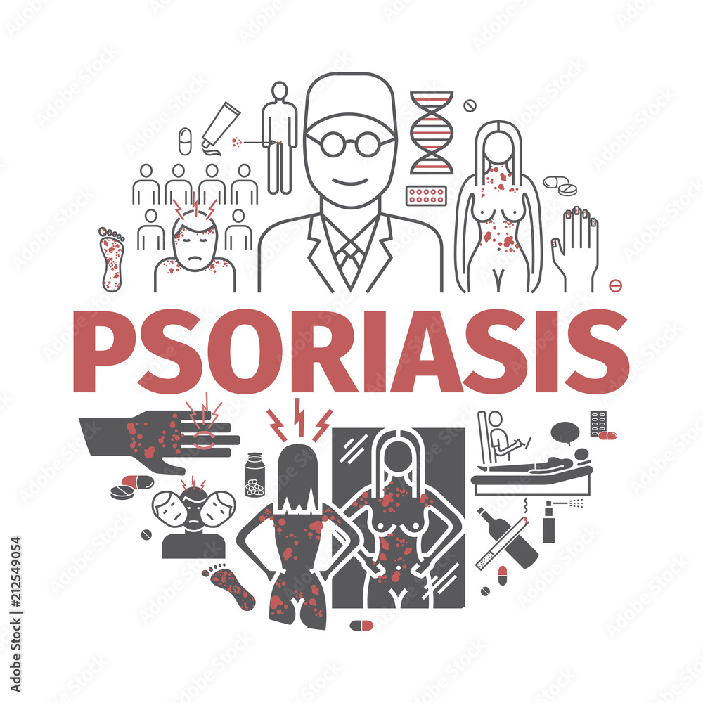 Psoriasis banner. Symptoms, Treatment. Vector illustration.