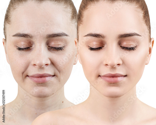Papier peint Woman face before and after rejuvenation.