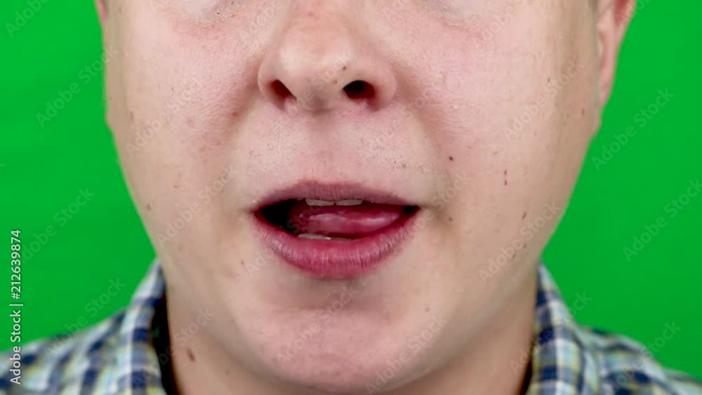 Infection tongue disease candida albicans Infection tongue disease candida albicans
