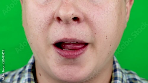 Infection tongue disease candida albicans