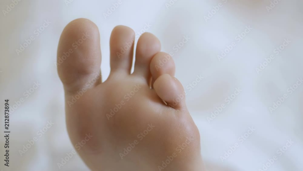 Female feet with skin peeling off. Foot peeling after the procedure. 素材