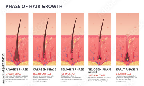 Medical infographic illustrations of hair growth cycle. Vector pictures of human biology