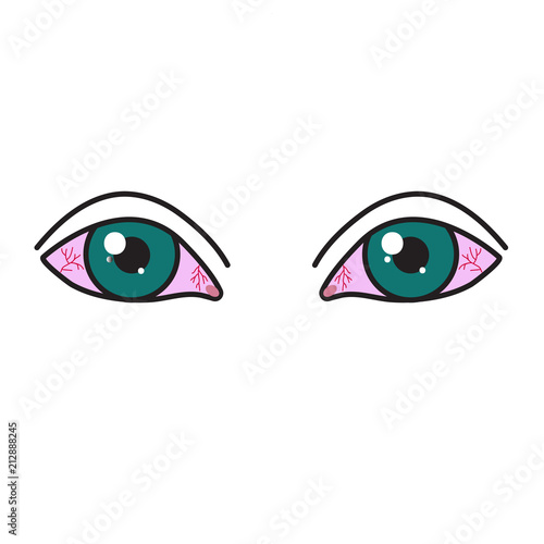 inflamed reddened eyes
