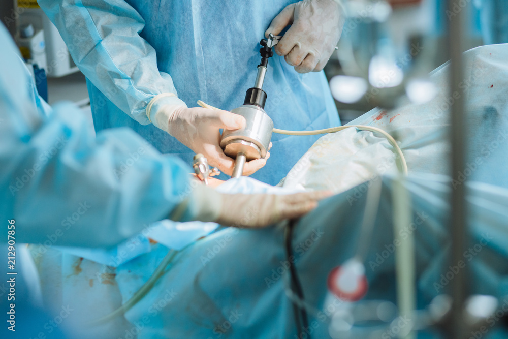 Close up of hands of surgeons team during process operation uterus removal with surgical laparoscopy instruments. Gynecology. Close up of hands of surgeons team during process operation uterus removal with surgical laparoscopy instruments. Gynecology.