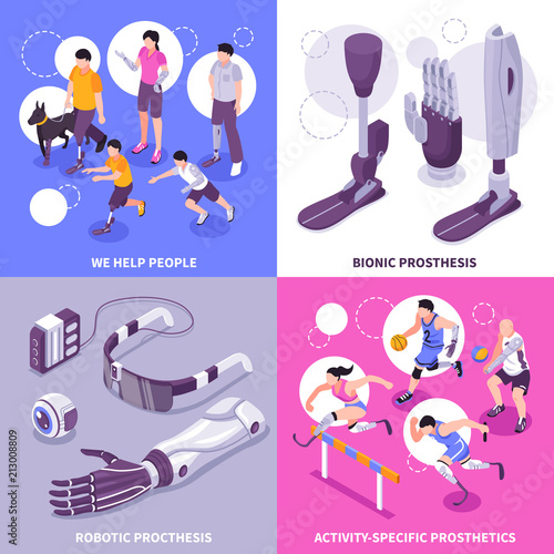 Bionic Prosthesis Isometric Concept