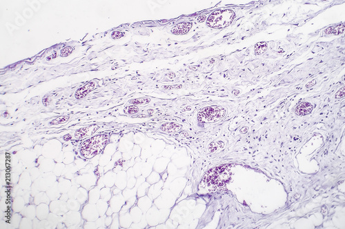 Granulomatous inflammation, light micrograph, photo under microscope photo