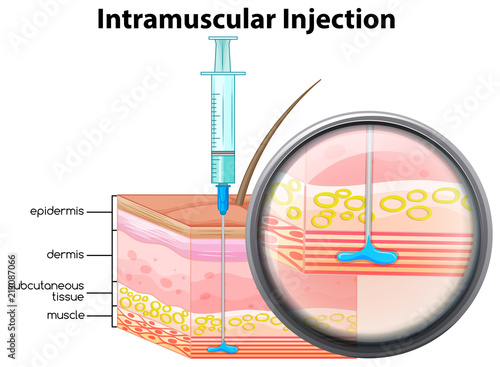 Human Skin Intramuscular Injection