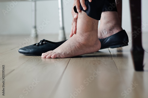 Elderly woman swollen feet putting on shoes photo