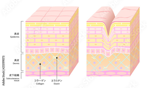 やさしい色合いの、立体的な肌の断面図。健康な肌とダメージ肌