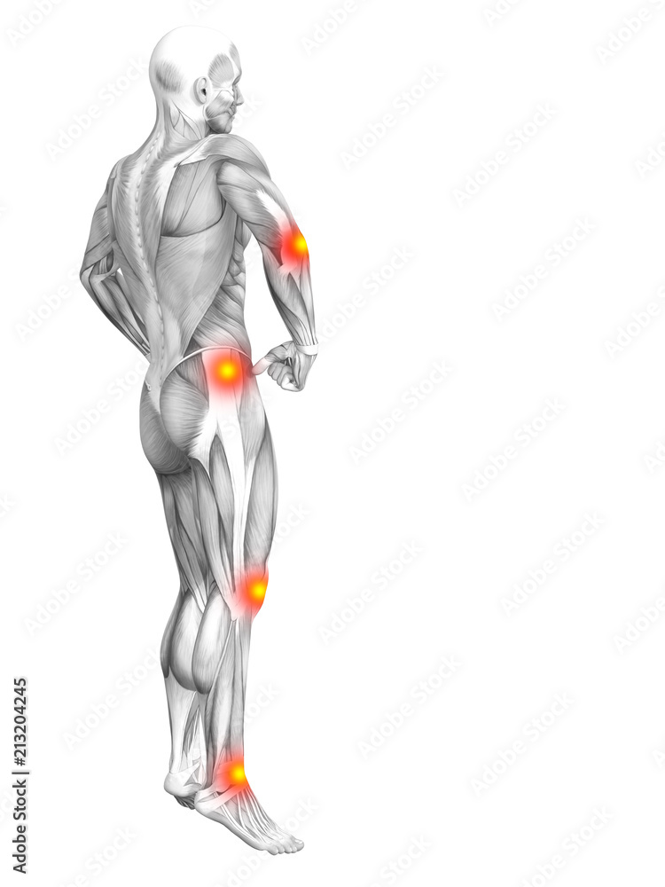 Conceptual human muscle anatomy with red and yellow hot spot inflammation or articular joint pain for health care therapy or sport concepts. 3D illustration man arthritis or bone osteoporosis disease