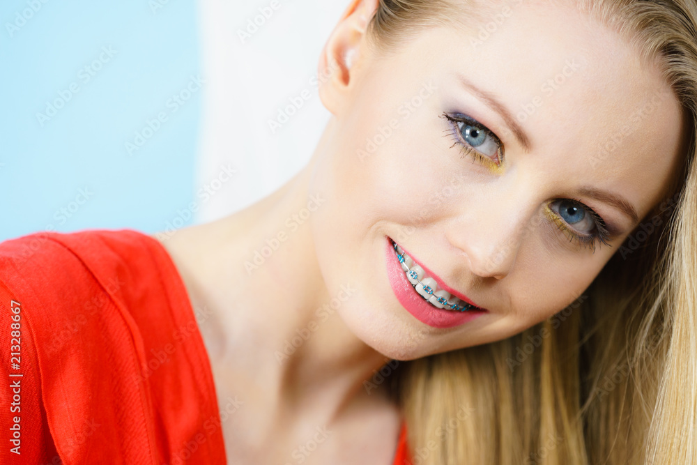 Woman showing her teeth with braces Woman showing her teeth with braces