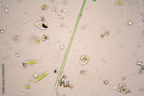 Microscopic organisms in pond water.  Oscillatoria simplicissima and Euglena Gracilis
 photo