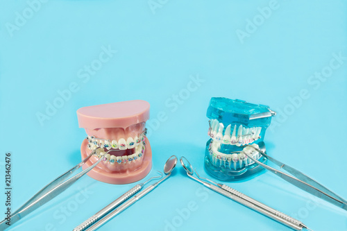 orthodontic model and dentist tool - demonstration teeth model of varities of orthodontic bracket or brace photo