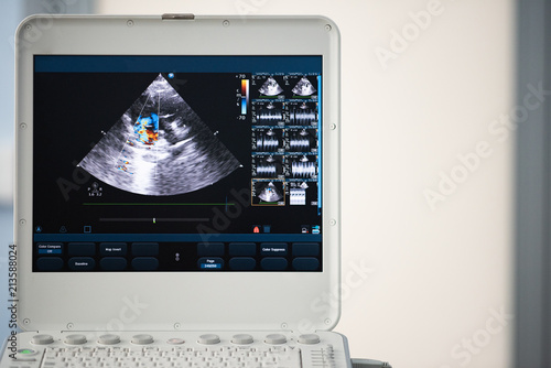 The monitor of the modern ultrasonic scanner with the image of blood flows through the heart cavity using the Doppler method. photo