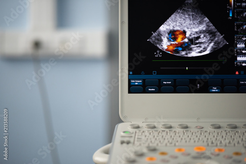 Screen modern ultrasound scanner with the image of interatrial communication. photo