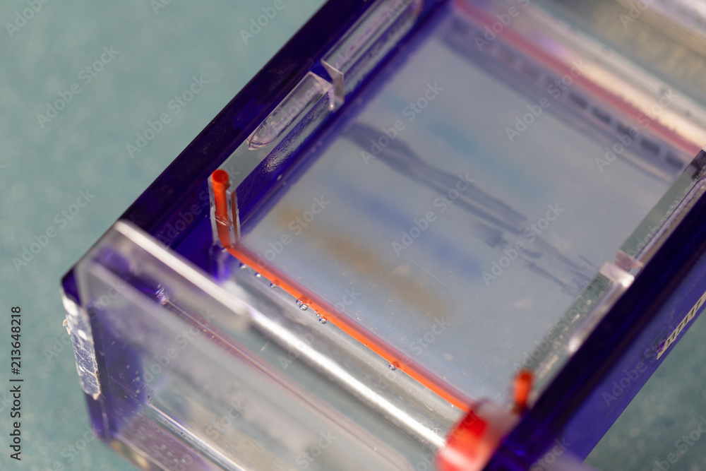 Agarose gel electrophoresis is a method of gel electrophoresis used in