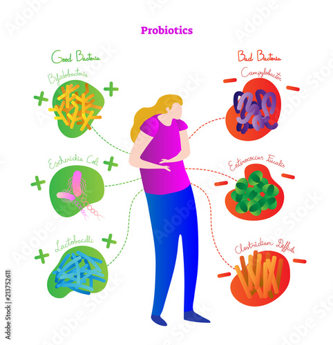 Probiotics conceptual vector illustration poster. Medical labeled diagram with female, stylized good and bad bacteria. Health care related information scheme.