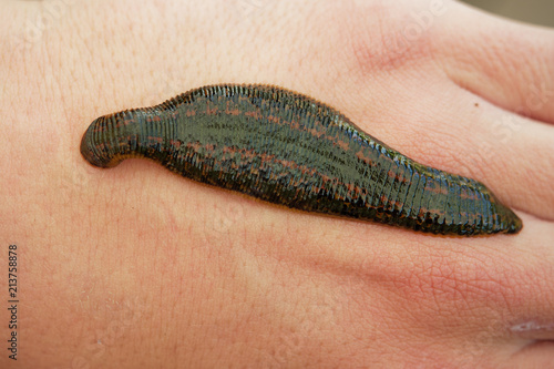 Canvastavla Medicinal Leech - Hirudo medicinalis - leech bite, leech is sucking blood on the