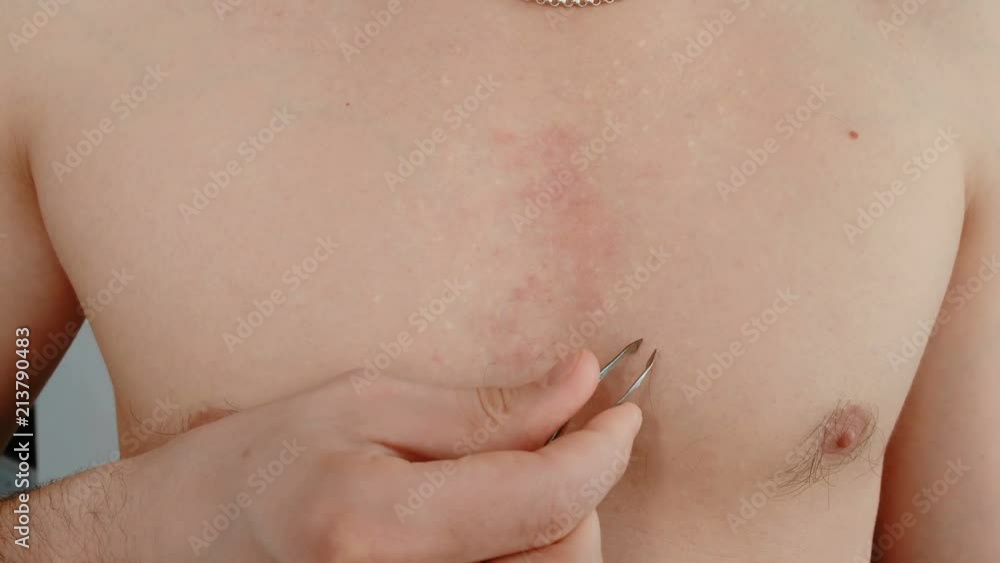 Close-up of a man's hand will pluck out his chest hair. Close-up of a man's hand will pluck out his chest hair.