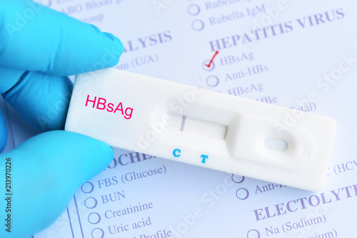 Hepatitis B virus negative test result by using rapid test cassette photo