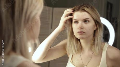Portrait of a teenager with problem skin, close-up