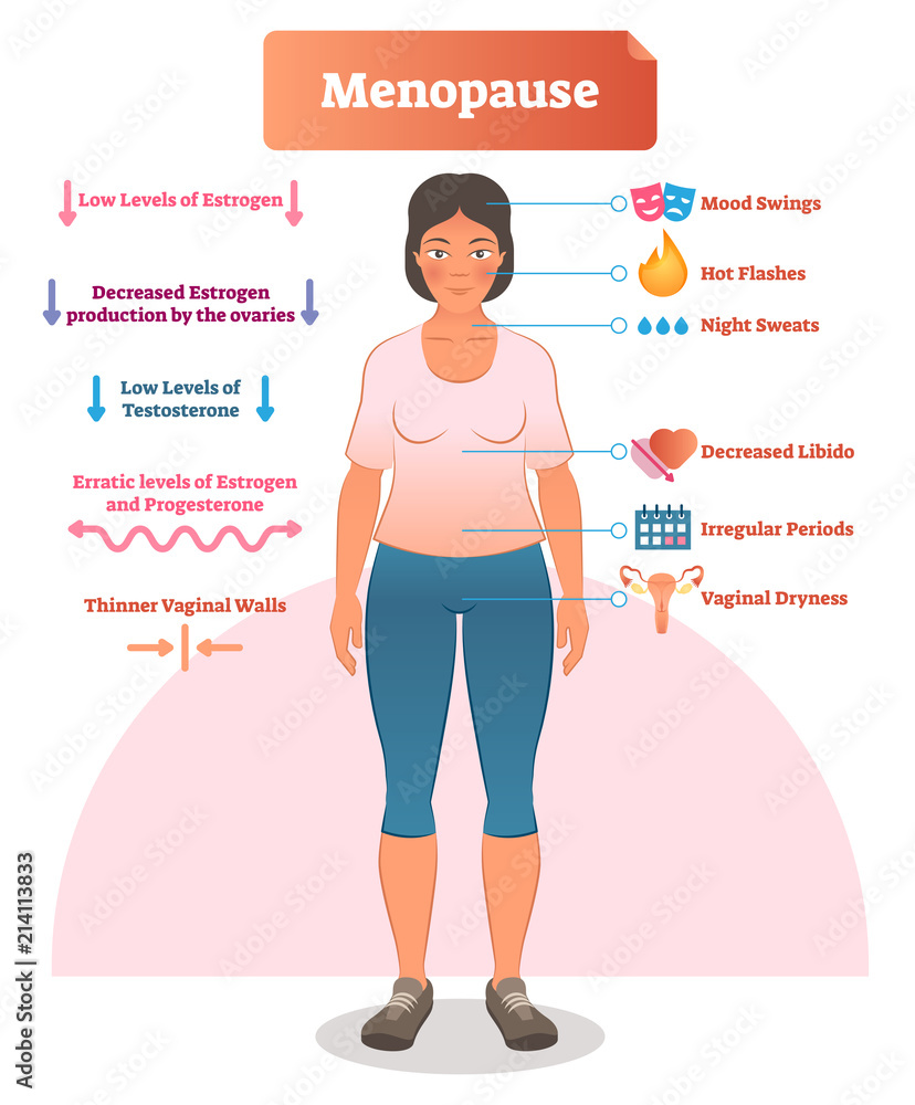 Menopause labeled vector illustration. Medical scheme and diagram with