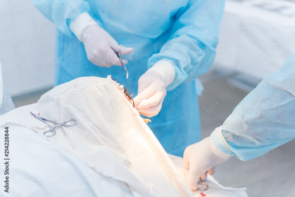 the hands of surgeons physicians doing surgery to the patient in the clinic, the concept of photo medicine, professional doctors, anesthesia the hands of surgeons physicians doing surgery to the patient in the clinic, the concept of photo medicine, professional doctors, anesthesia