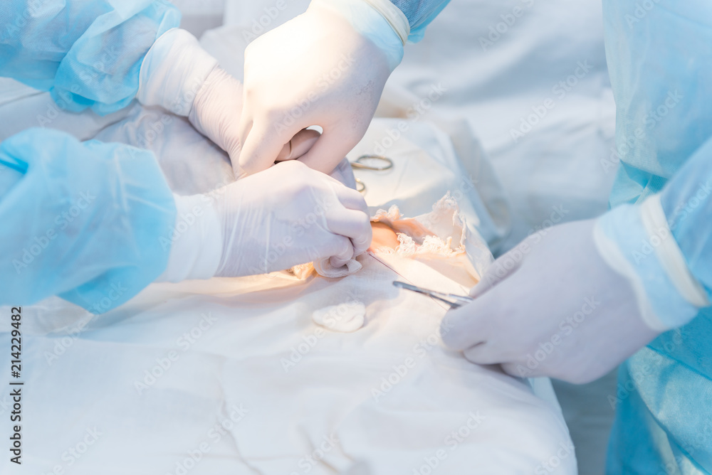 the hands of surgeons physicians doing surgery to the patient in the clinic, the concept of photo medicine, professional doctors, anesthesia the hands of surgeons physicians doing surgery to the patient in the clinic, the concept of photo medicine, professional doctors, anesthesia