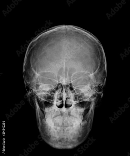 head skull x-ray front view