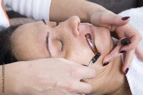 Middle-Aged Woman Receiving Facial Epilation Closeup