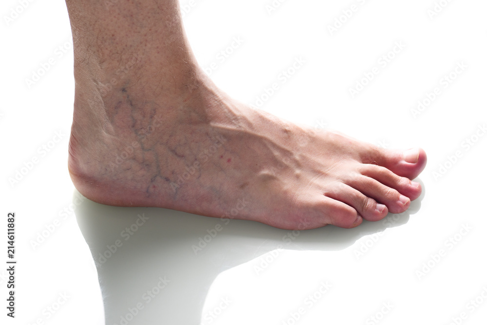 Fototapeta premium Cropped view of tired feet