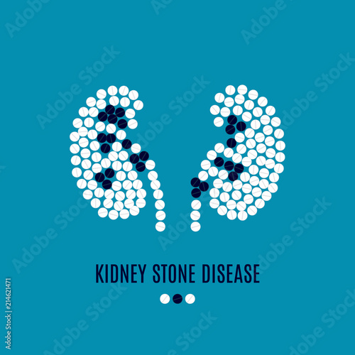 Kidney stone disease awareness poster with kidneys made of white and black pills on blue background. Renal stones. Medical solidarity concept. Human body organ anatomy icon. Vector illustration.
