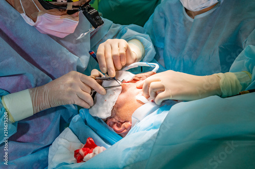 Plastic surgery in operating room photo