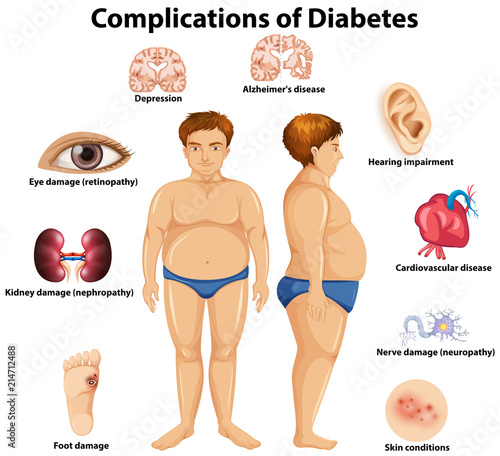 Complications of Diabetes concept