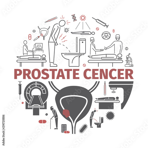 Prostate Cancer. Symptoms, Causes, Treatment. Vector Icons.