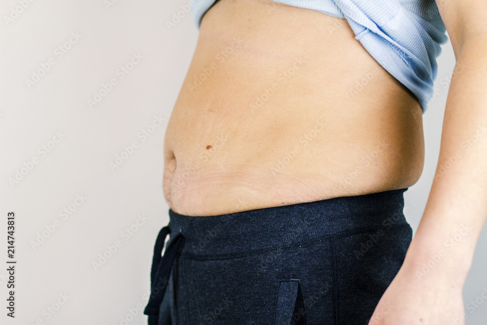 Naklejka premium Fat man's body