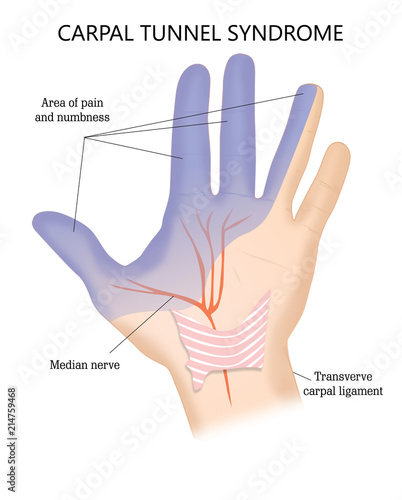 Fotografie Transverse Carpal Ligament